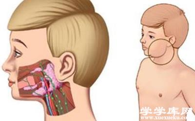 腮腺炎的早期癥狀 腮腺炎怎么治療