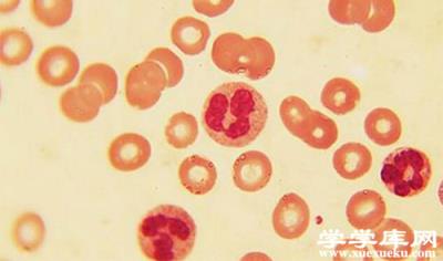 白細胞低是怎么回事 白細胞低對人體的危害