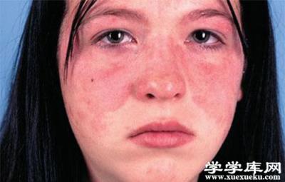 白細胞低是怎么回事 白細胞低對人體的危害