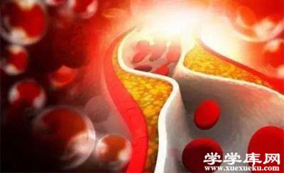 血脂高的癥狀表現 血脂高怎么辦