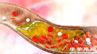 血脂高的癥狀表現 血脂高怎么辦