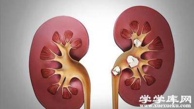 腎結石的早期癥狀 出現這些情況警惕腎結石