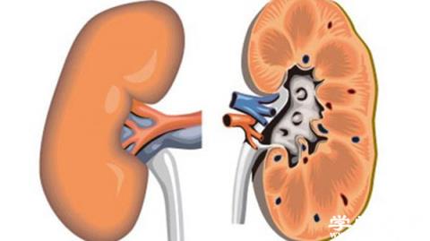 尿毒癥是怎么引起的 尿毒癥與哪些因素有關