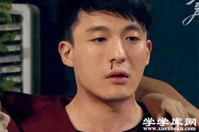 流鼻血是什么原因 流鼻血怎樣處理