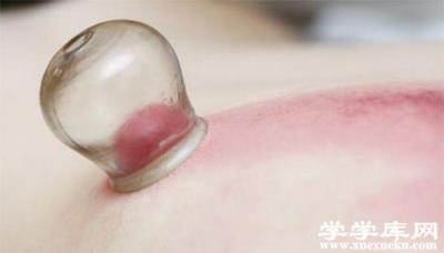 拔罐減肥有效嗎 中醫拔罐有啥好處